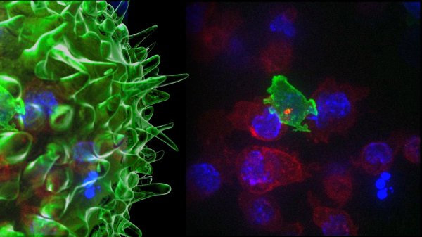 [v]科学家记录下T细胞杀死癌细胞全过程