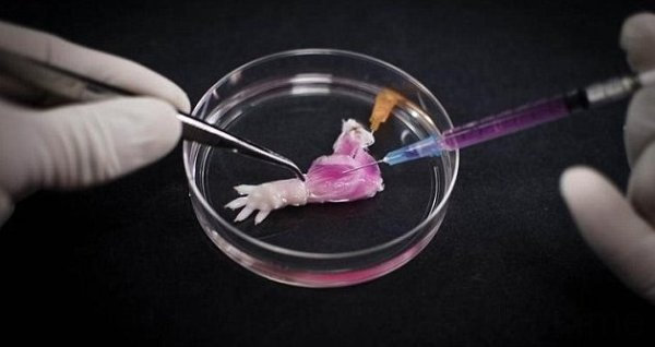 实验室里培养出首个生物假肢